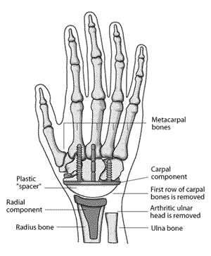 Diagram: anatomy of the wrist